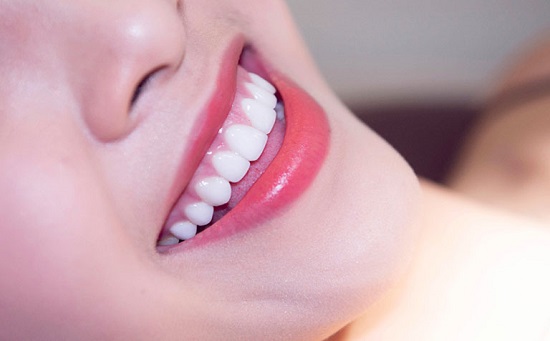 Trồng răng sứ có tốt không? Những điều cần biết 3
