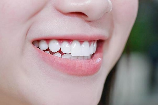 Trồng răng sứ dùng được bao lâu? Tham khảo 1